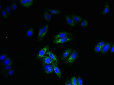 Immunocytochemistry/ Immunofluorescence - Anti-SPTLC3 antibody (AB237532)