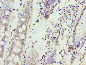 Immunohistochemistry (Formalin/PFA-fixed paraffin-embedded sections) - Anti-SPTLC3 antibody (AB237532)
