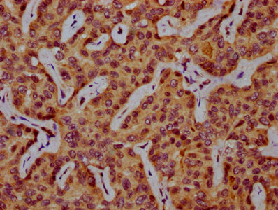 Immunohistochemistry (Formalin/PFA-fixed paraffin-embedded sections) - Anti-SPTLC3 antibody (AB237532)