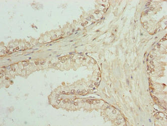 Immunohistochemistry (Formalin/PFA-fixed paraffin-embedded sections) - Anti-SPTLC3 antibody (AB237532)