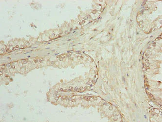 Immunohistochemistry (Formalin/PFA-fixed paraffin-embedded sections) - Anti-SPTLC3 antibody (AB237532)