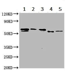 Western blot - Anti-SPTLC3 antibody (AB237532)