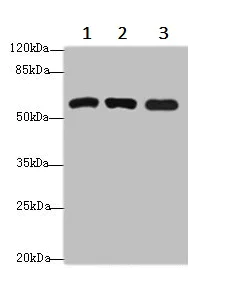Western blot - Anti-SPTLC3 antibody (AB237532)