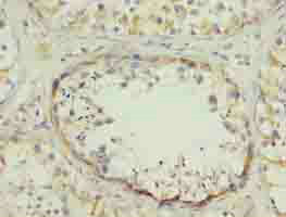 Immunohistochemistry (Formalin/PFA-fixed paraffin-embedded sections) - Anti-SPZ1 antibody (AB235302), expandable thumbnail