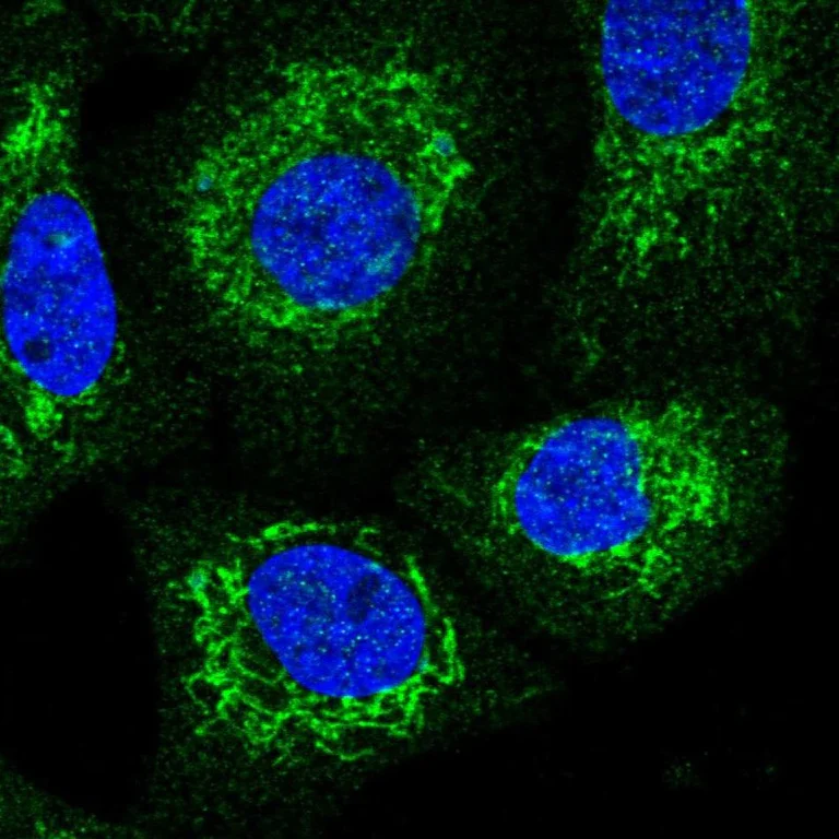 Immunocytochemistry/ Immunofluorescence - Anti-SQRDL antibody (AB272574)