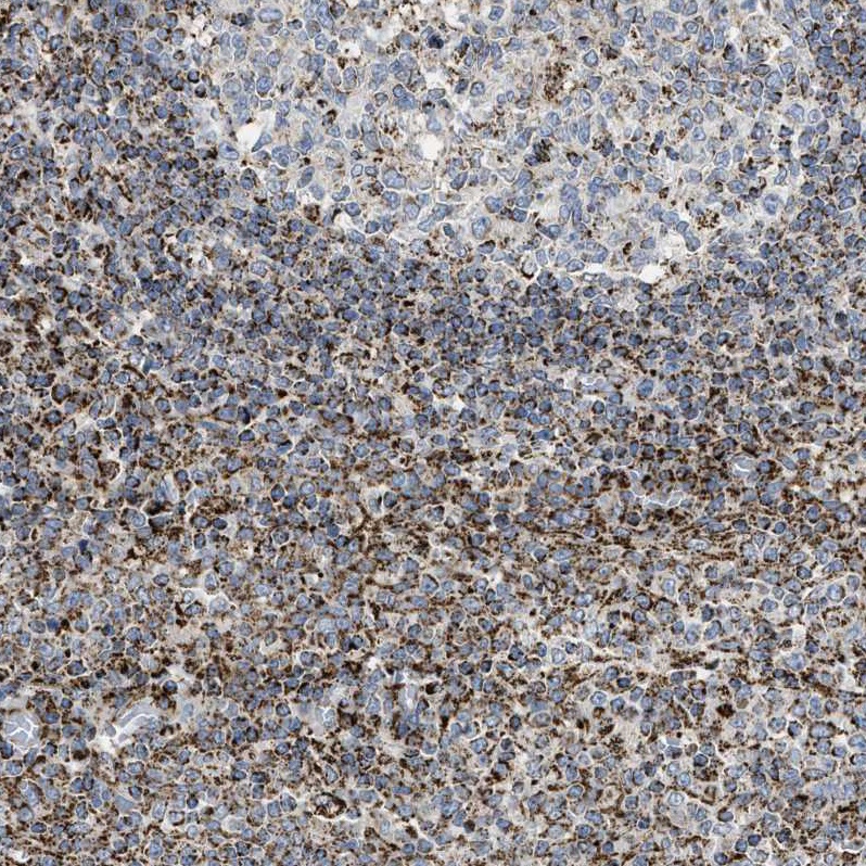 Immunohistochemistry (Formalin/PFA-fixed paraffin-embedded sections) - Anti-SQRDL antibody (AB272574)