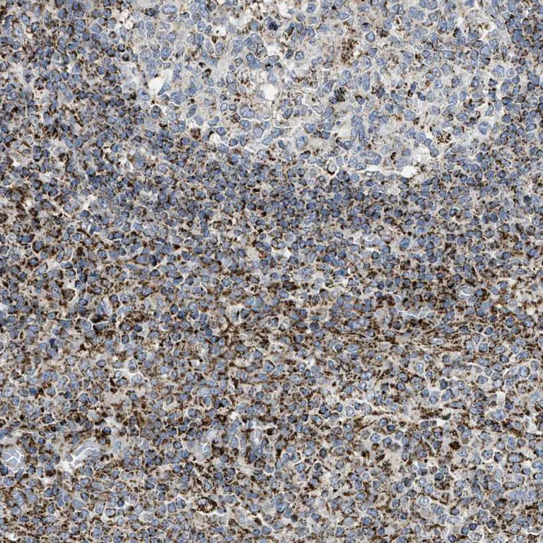Immunohistochemistry (Formalin/PFA-fixed paraffin-embedded sections) - Anti-SQRDL antibody (AB272574)