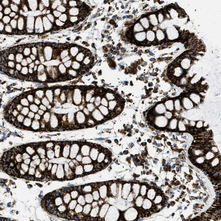 Immunohistochemistry (Formalin/PFA-fixed paraffin-embedded sections) - Anti-SQRDL antibody (AB272574)