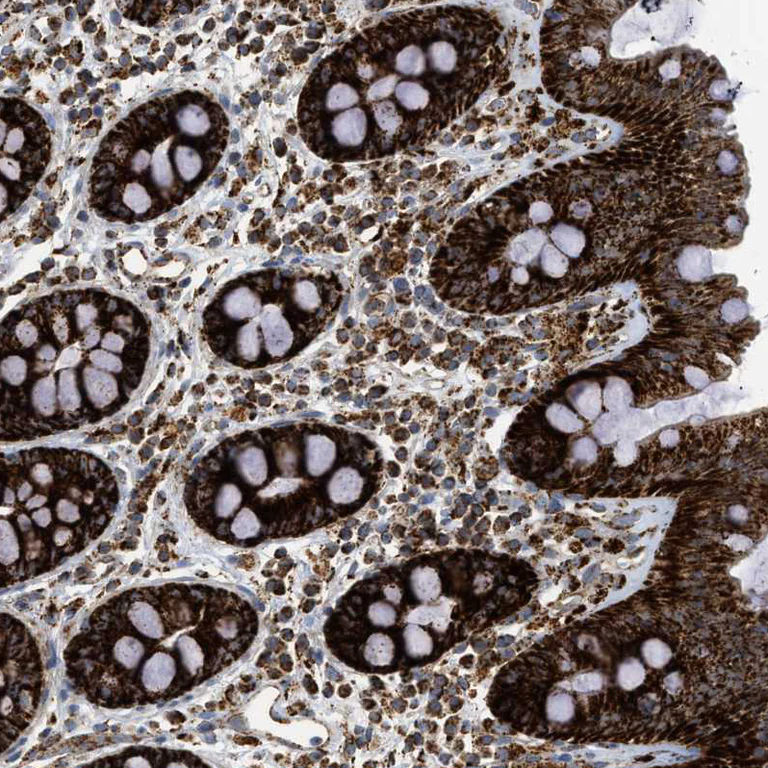 Immunohistochemistry (Formalin/PFA-fixed paraffin-embedded sections) - Anti-SQRDL antibody (AB272574)