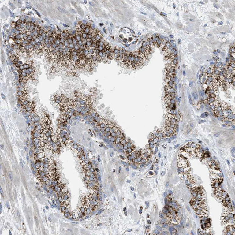 Immunohistochemistry (Formalin/PFA-fixed paraffin-embedded sections) - Anti-SQRDL antibody (AB272574)