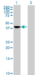 Western blot - Anti-SQRDL antibody (AB71978), expandable thumbnail