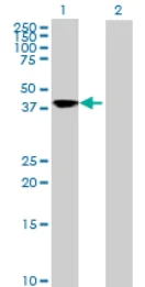 Western blot - Anti-SQRDL antibody (AB71978)
