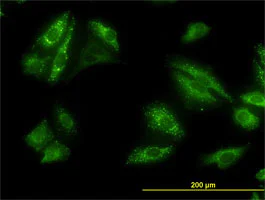 Immunocytochemistry/ Immunofluorescence - Anti-SQSTM1 / p62 antibody [2C11] - BSA and Azide free (AB56416)