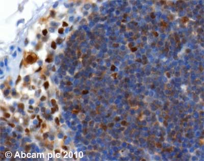Immunohistochemistry (Formalin/PFA-fixed paraffin-embedded sections) - Anti-SQSTM1 / p62 antibody [2C11] - BSA and Azide free (ab56416), expandable thumbnail