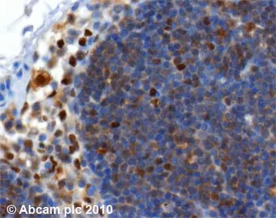 Immunohistochemistry (Formalin/PFA-fixed paraffin-embedded sections) - Anti-SQSTM1 / p62 antibody [2C11] - BSA and Azide free (AB56416)