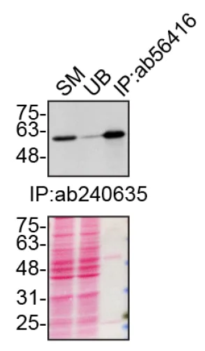 Immunoprecipitation - Anti-SQSTM1 / p62 antibody [2C11] - BSA and Azide free (AB56416)