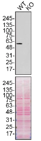 Western blot - Anti-SQSTM1 / p62 antibody [2C11] - BSA and Azide free (AB56416)