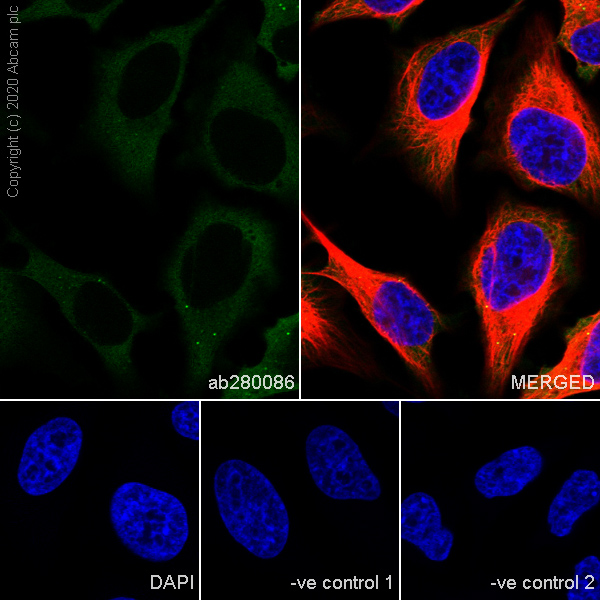 Immunocytochemistry/ Immunofluorescence - Anti-SQSTM1 / p62 antibody [3/P62 LCK LIGAND] (ab280086), expandable thumbnail