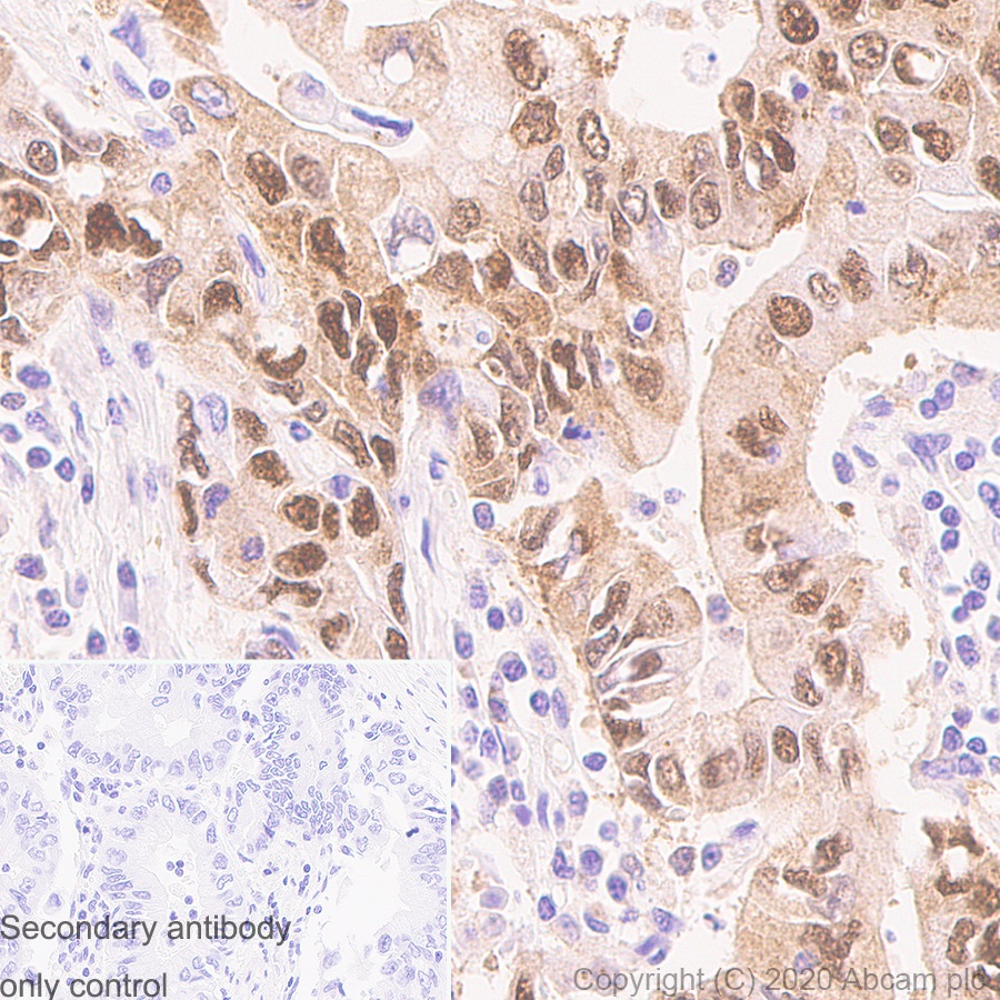 Immunohistochemistry (Formalin/PFA-fixed paraffin-embedded sections) - Anti-SQSTM1 / p62 antibody [3/P62 LCK LIGAND] (AB280086), expandable thumbnail