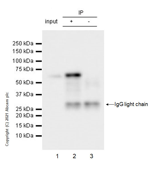 Immunoprecipitation - Anti-SQSTM1 / p62 antibody [3/P62 LCK LIGAND] - Autophagosome Marker (AB280086), expandable thumbnail
