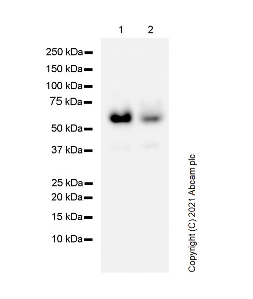 Western blot - Anti-SQSTM1 / p62 antibody [3/P62 LCK LIGAND] - Autophagosome Marker (AB280086), expandable thumbnail