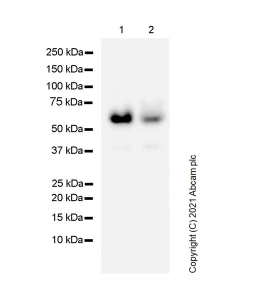 Western blot - Anti-SQSTM1 / p62 antibody [3/P62 LCK LIGAND] - Autophagosome Marker (AB280086)