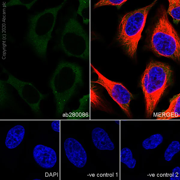 Immunocytochemistry/ Immunofluorescence - Anti-SQSTM1 / p62 antibody [3/P62 LCK LIGAND] - BSA and Azide free (AB280091)