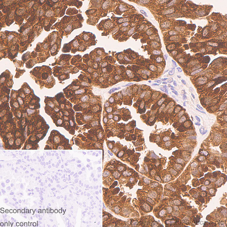 Immunohistochemistry (Formalin/PFA-fixed paraffin-embedded sections) - Anti-SQSTM1 / p62 antibody [3/P62 LCK LIGAND] - BSA and Azide free (AB280091)