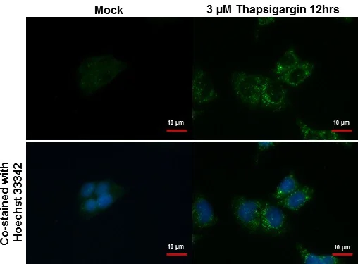 Immunocytochemistry/ Immunofluorescence - Anti-SQSTM1 / p62 antibody - Autophagosome Marker (AB155686)