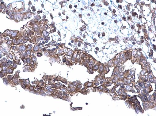 Immunohistochemistry (Formalin/PFA-fixed paraffin-embedded sections) - Anti-SQSTM1 / p62 antibody - Autophagosome Marker (AB155686), expandable thumbnail