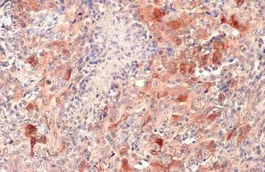 Immunohistochemistry (Formalin/PFA-fixed paraffin-embedded sections) - Anti-SQSTM1 / p62 antibody - Autophagosome Marker (AB155686)