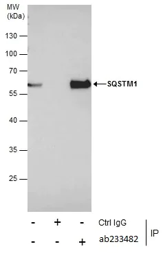 Immunoprecipitation - Anti-SQSTM1 / p62 antibody - Autophagosome Marker (AB155686)