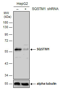 Western blot - Anti-SQSTM1 / p62 antibody - Autophagosome Marker (AB155686)