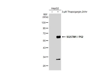 Western blot - Anti-SQSTM1 / p62 antibody - Autophagosome Marker (AB155686)