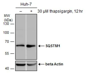 Western blot - Anti-SQSTM1 / p62 antibody - Autophagosome Marker (AB155686)