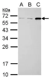 Western blot - Anti-SQSTM1 / p62 antibody - Autophagosome Marker (AB155686)