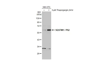 Western blot - Anti-SQSTM1 / p62 antibody - Autophagosome Marker (AB155686)