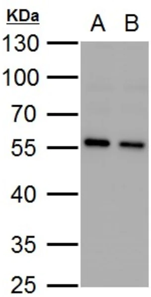 Western blot - Anti-SQSTM1 / p62 antibody - Autophagosome Marker (AB155686)