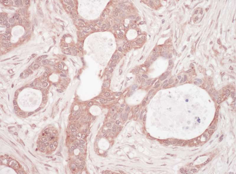 Immunohistochemistry (Formalin/PFA-fixed paraffin-embedded sections) - Anti-SQSTM1 / p62 antibody - Autophagosome Marker (AB264313)