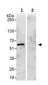 Immunoprecipitation - Anti-SQSTM1 / p62 antibody - Autophagosome Marker (AB264313)