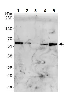 Western blot - Anti-SQSTM1 / p62 antibody - Autophagosome Marker (AB264313)