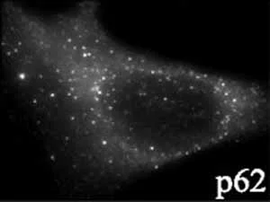 Immunocytochemistry/ Immunofluorescence - Anti-SQSTM1 / p62 antibody - Autophagosome Marker (AB91526)