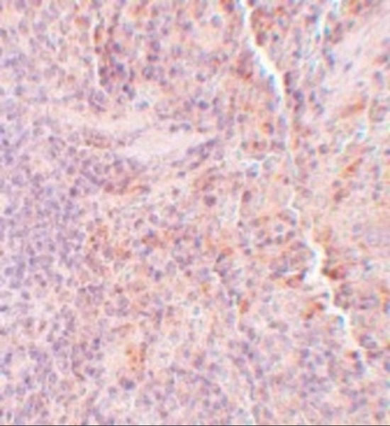 Immunohistochemistry (Formalin/PFA-fixed paraffin-embedded sections) - Anti-SQSTM1 / p62 antibody (ab91526), expandable thumbnail