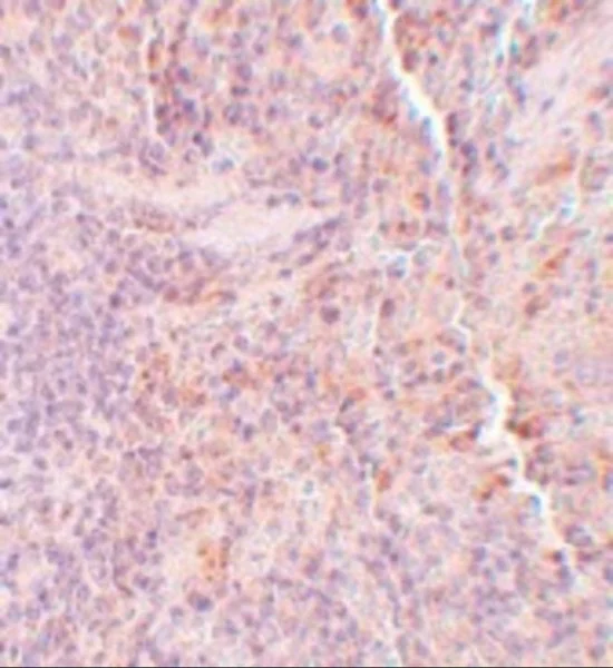 Immunohistochemistry (Formalin/PFA-fixed paraffin-embedded sections) - Anti-SQSTM1 / p62 antibody - Autophagosome Marker (AB91526)