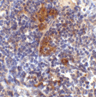 Immunohistochemistry (Formalin/PFA-fixed paraffin-embedded sections) - Anti-SQSTM1 / p62 antibody (ab91526), expandable thumbnail