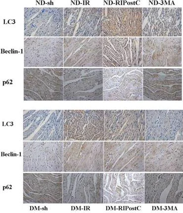 Immunohistochemistry (Formalin/PFA-fixed paraffin-embedded sections) - Anti-SQSTM1 / p62 antibody - Autophagosome Marker (AB91526)