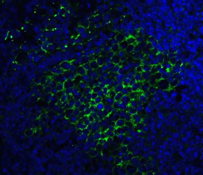 Immunohistochemistry (Formalin/PFA-fixed paraffin-embedded sections) - Anti-SQSTM1 / p62 antibody (AB91526), expandable thumbnail