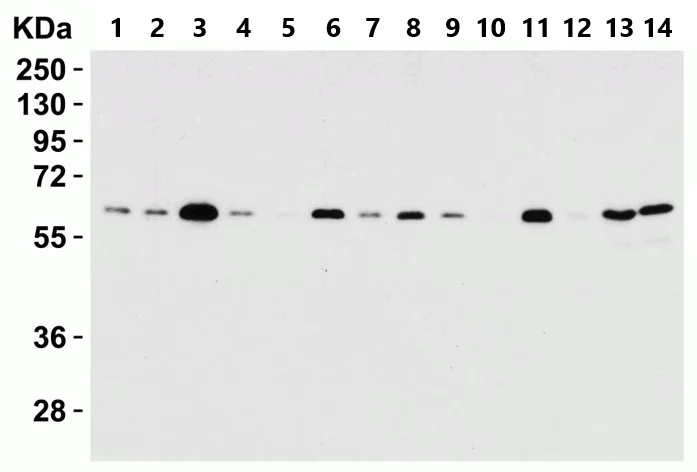 Western blot - Anti-SQSTM1 / p62 antibody - Autophagosome Marker (AB91526)