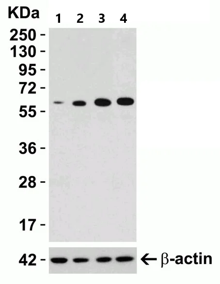 Western blot - Anti-SQSTM1 / p62 antibody - Autophagosome Marker (AB91526)