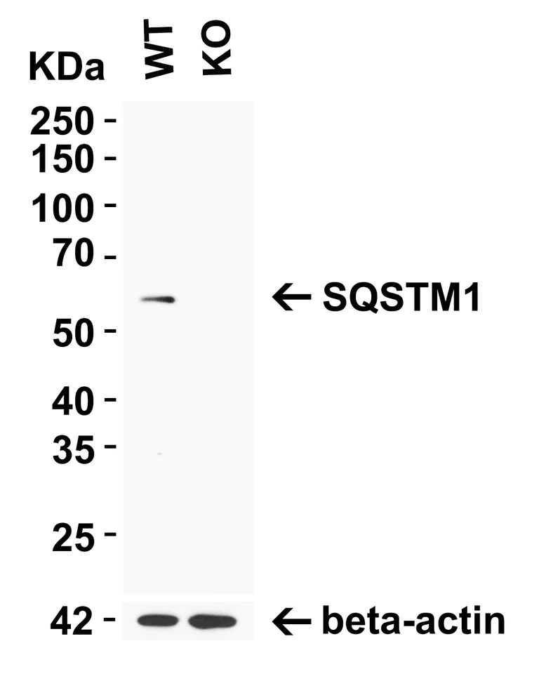 Western blot - Anti-SQSTM1 / p62 antibody - Autophagosome Marker (AB91526)
